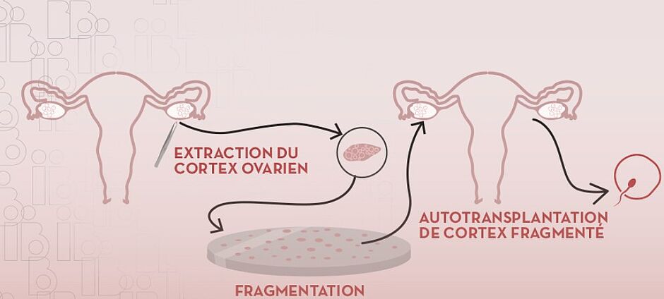 Agrandir l'image (fenêtre modale)