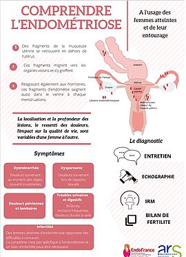 Agrandir l'image (fenêtre modale)