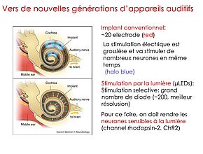 Agrandir l'image (fenêtre modale)